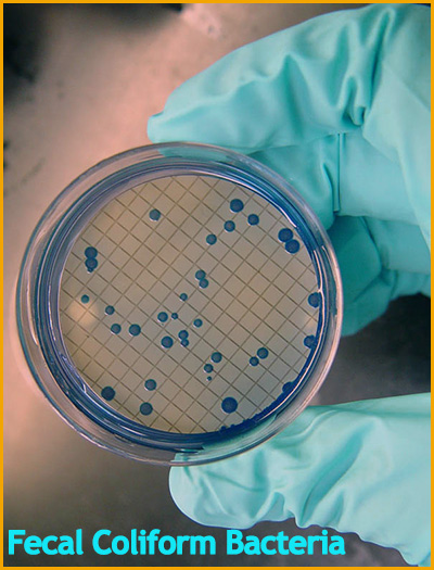 fecal coliform bacteria grows on our toothbrushes after being sprayed on by flushing the toilet